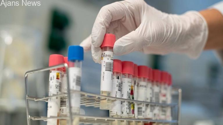 Nobel ödülü Kimyager 5 dakika’da sonuç veren Covid-19 testi yaptı