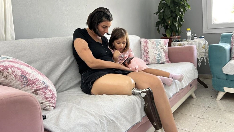 Depremde bacağını kaybeden Senem’e 2. El Protez Bacak Sattılar