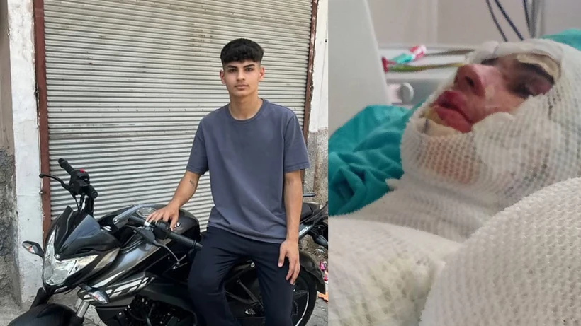 Adana’da Miras Anlaşmazlığı Kan Dondurdu: Amca, 16 Yaşındaki Yeğenini yaktı
