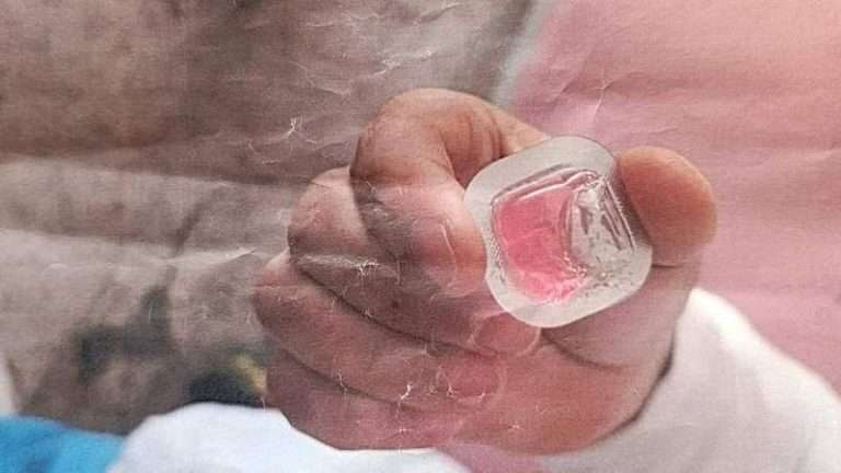 Diyarbakır’da Kuduz Jeli Paniği!