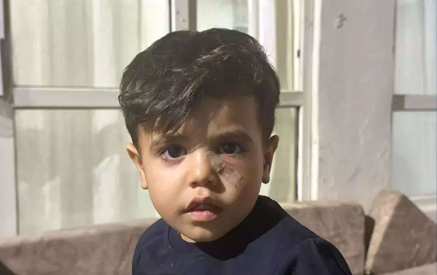 Evinin Avlusunda Oynayan 4 Yaşındaki Çocuğa ‘Yorgun Mermi’ İsabet Etti