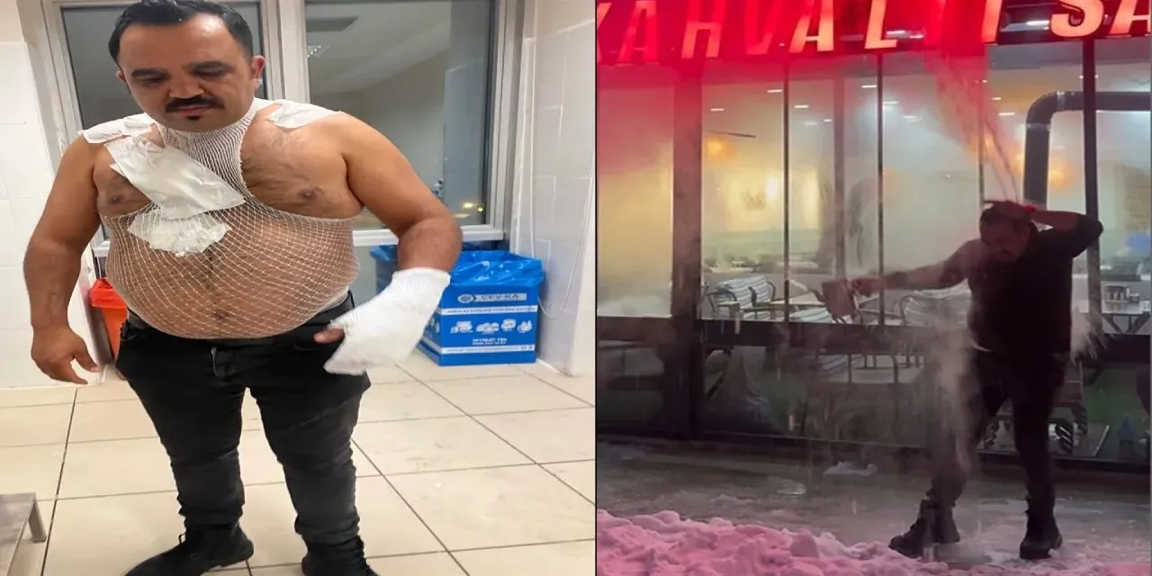 Sivas’ta “Soğuk Hava Challenge”ı Hastanede Bitti!