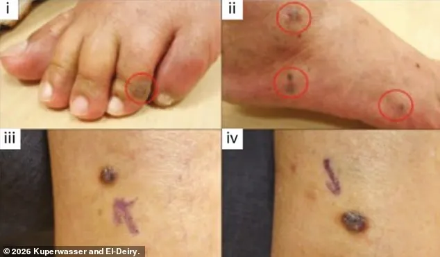 Kovid Aşıları ve “Hızlı İlerleyen Kanser” Şüphesi