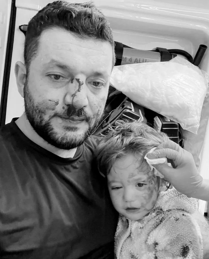 Yalova’da Komşu Dehşeti: 14 Aylık Bebeğin Kafatası Çatladı!